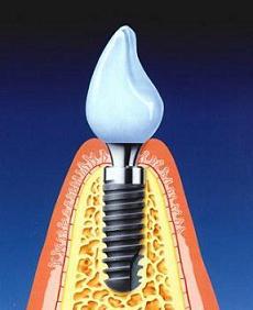 Fähigkeiten der zahnbehandlung. Dental care.